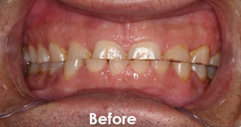 Before Image 1