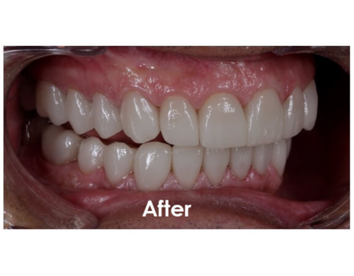 After Image 1