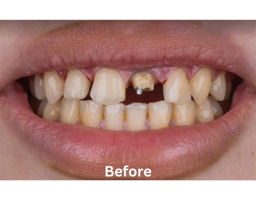 Before Image 4